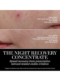 The Night Recovery Concentrate