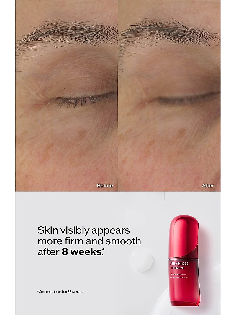 Ultimune Power Infusing Serum