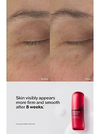 Ultimune Power Infusing Serum