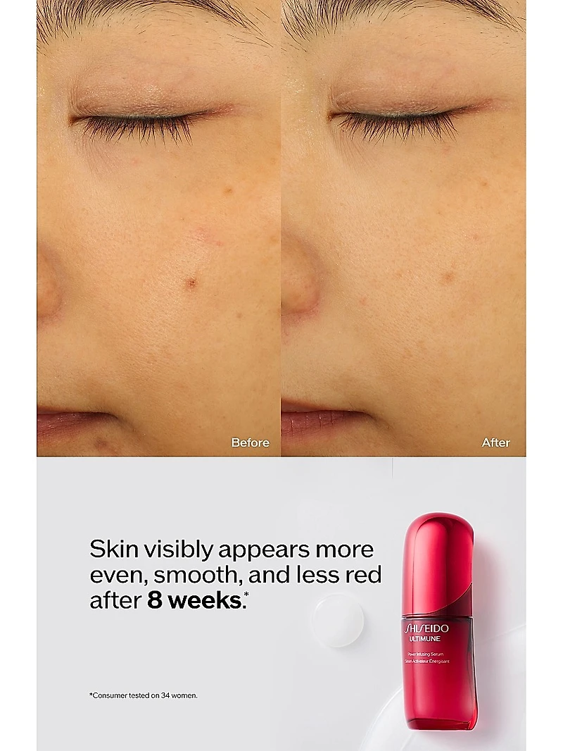 Ultimune Power Infusing Serum