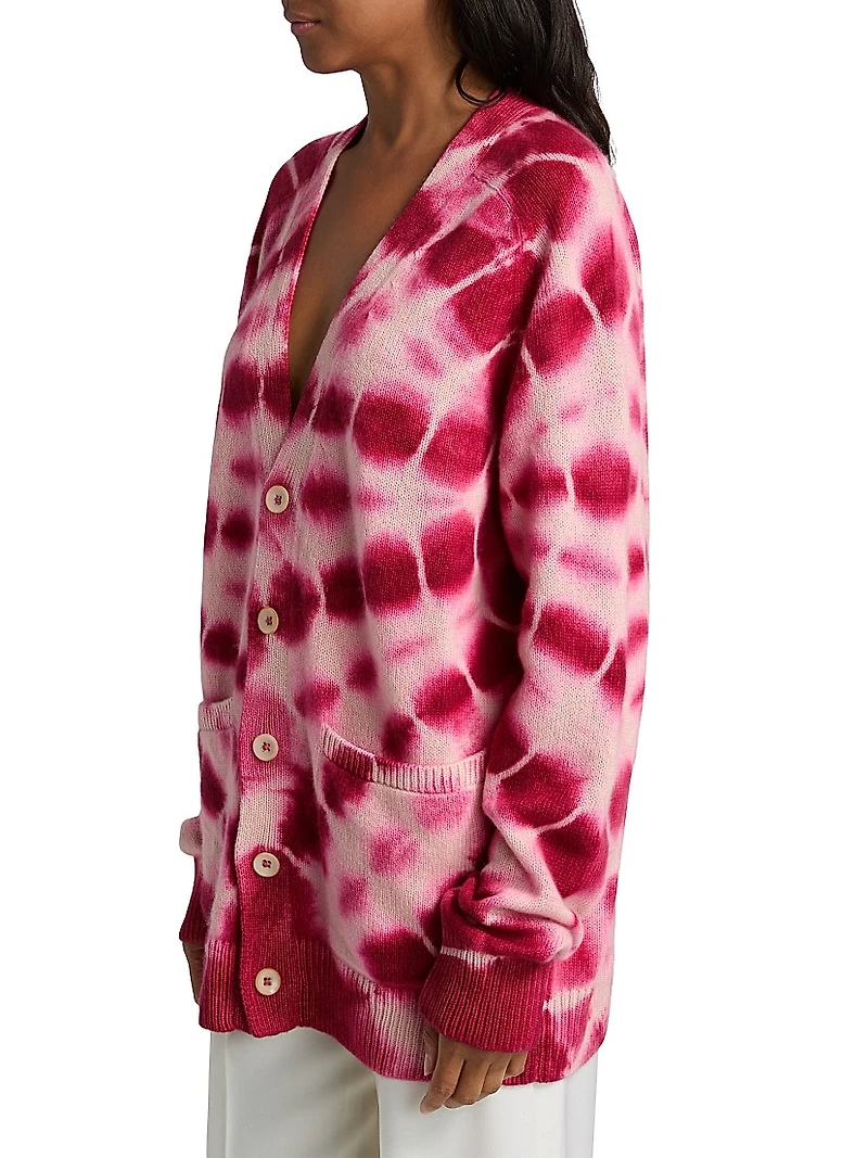 Tie-Dye Relaxed Cardigan