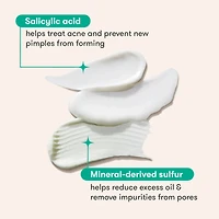 Proactiv Gentle 3 step Acne Routine Kit