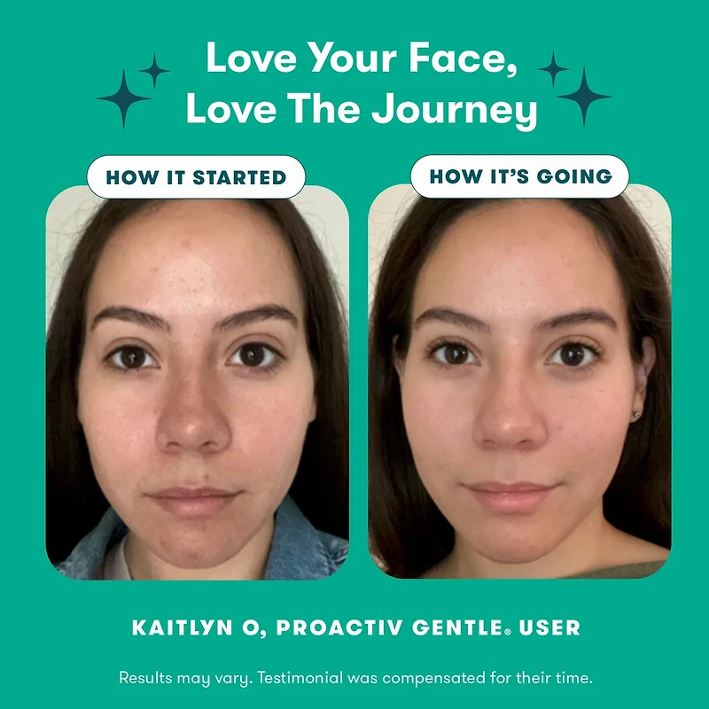 Proactiv Gentle 3 step Acne Routine Kit
