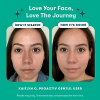 Proactiv Gentle 3 step Acne Routine Kit