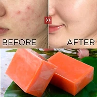 Kojic Acid Soap Bars (3pk)
