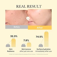 KojicLux Kojic & Turmeric Face Mask (4 Pack)
