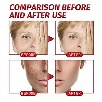 KojicLux Kojic Acid Facial Cream (50g)