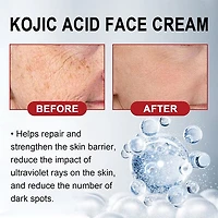 KojicLux Kojic Acid Facial Cream (50g)