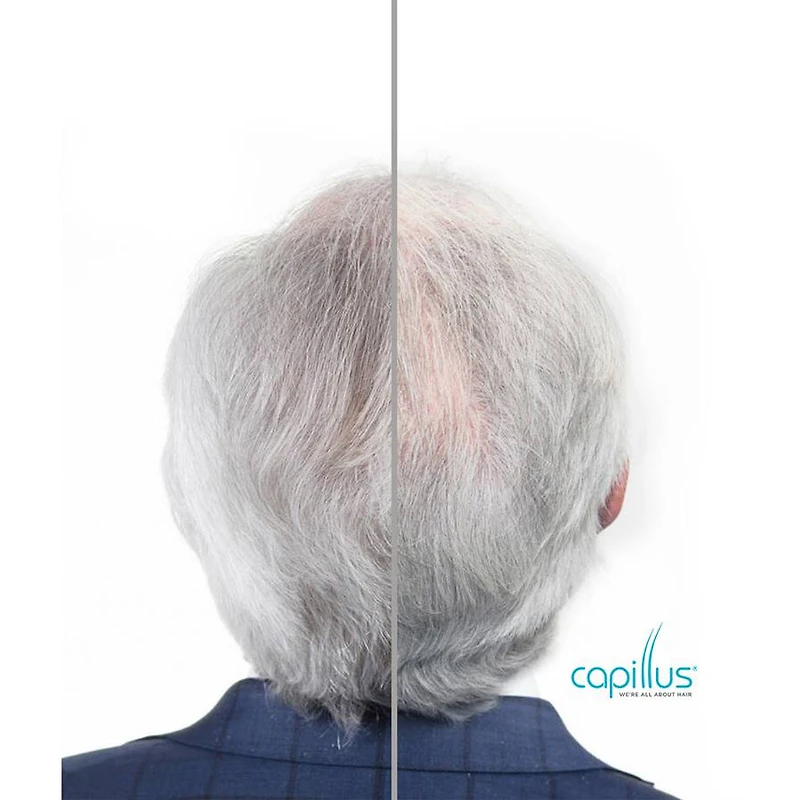 CapillusPro 272 Hair Laser Regrowth Theraphy System