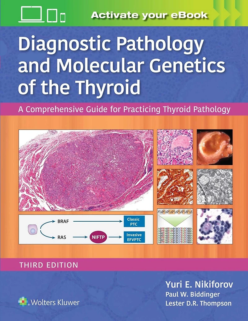 Diagnostic Pathology and Molecular Genetics of the Thyroid: A Comprehensive Guide for Practicing Thyroid