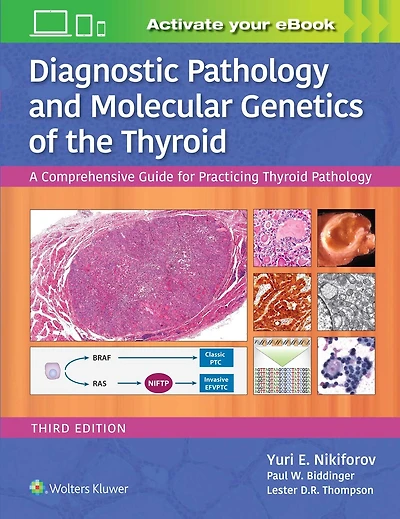 Diagnostic Pathology and Molecular Genetics of the Thyroid: A Comprehensive Guide for Practicing Thyroid