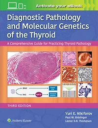 Diagnostic Pathology and Molecular Genetics of the Thyroid: A Comprehensive Guide for Practicing Thyroid