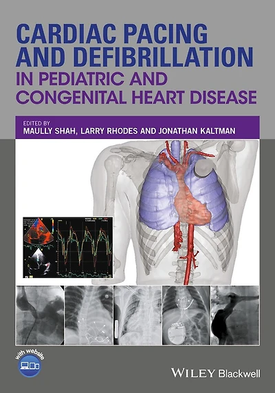 Cardiac Pacing and Defibrillation Pediatric Congenital Heart Disease