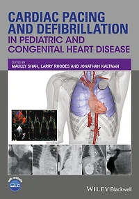 Cardiac Pacing and Defibrillation Pediatric Congenital Heart Disease