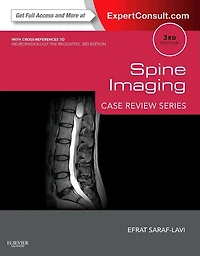 Spine Imaging: Case Review Series: Expert Consult - Online And Print