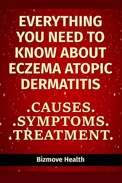 Everything you need to know about Eczema - Atopic Dermatitis: Causes, Symptoms, Treatment