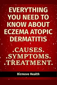 Everything you need to know about Eczema - Atopic Dermatitis: Causes, Symptoms, Treatment
