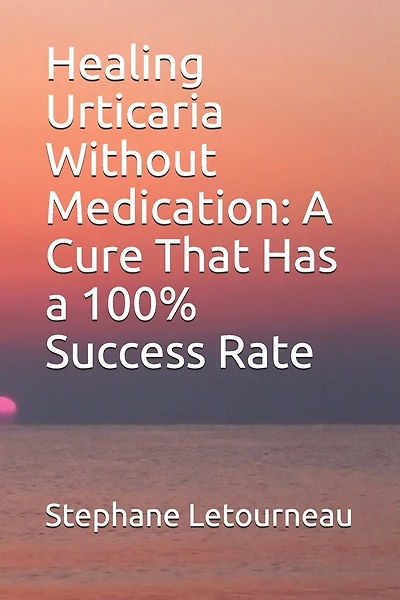 Healing Urticaria Without Medication: A Cure That Has a 100% Success Rate