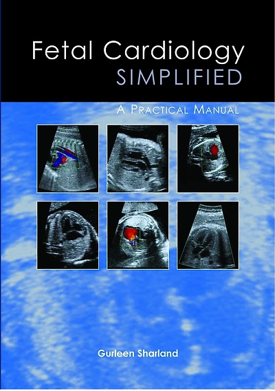 Fetal Cardiology Simplified: A Practical Manual