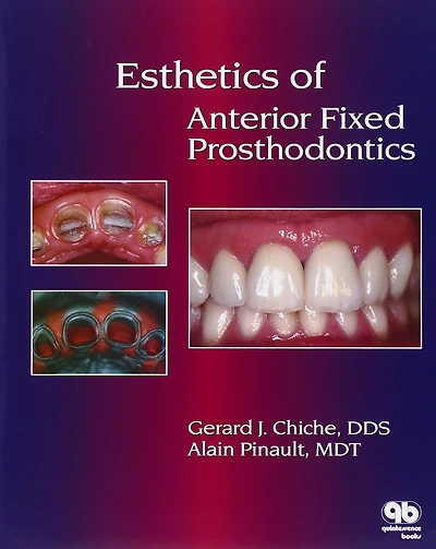 Esthetics of Anterior Fixed Prosthodontics