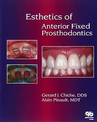 Esthetics of Anterior Fixed Prosthodontics