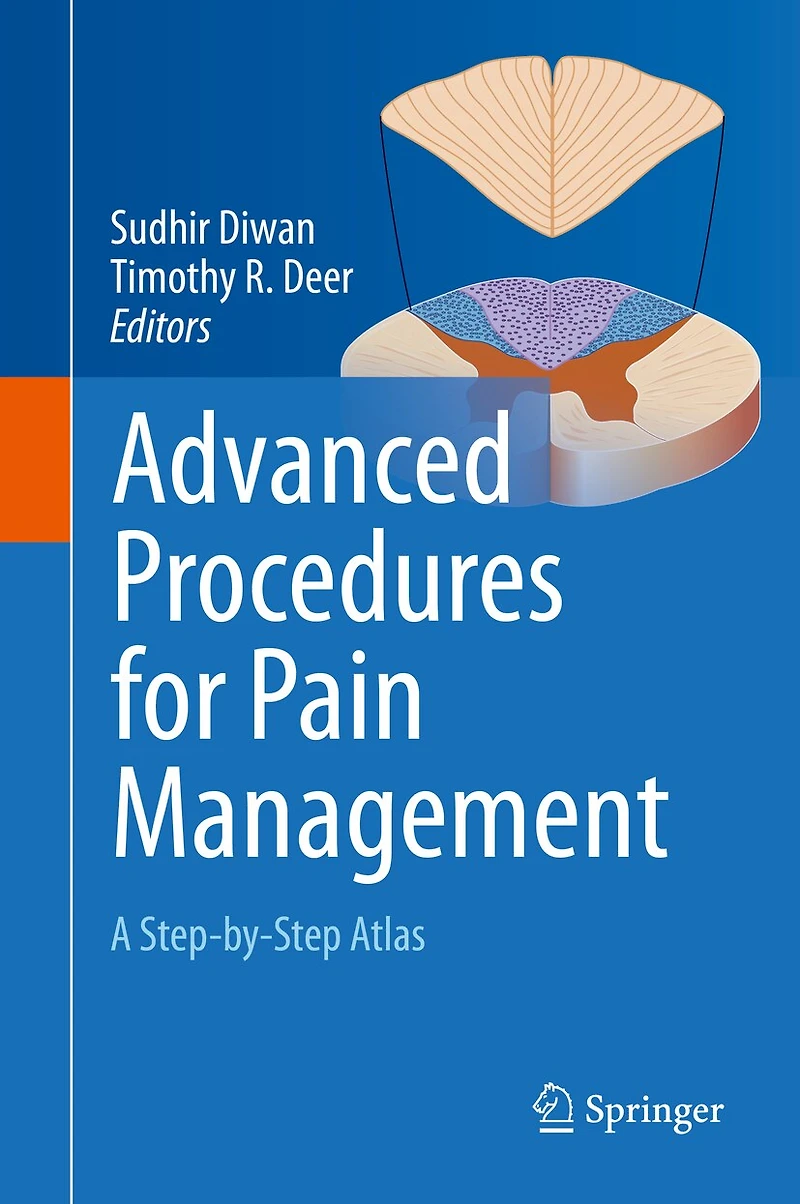 Advanced Procedures for Pain Management: A Step-by-Step Atlas