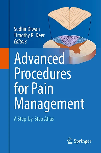 Advanced Procedures for Pain Management: A Step-by-Step Atlas