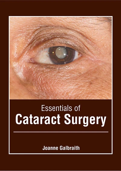 Essentials Of Cataract Surgery