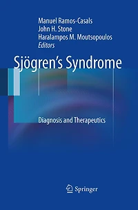Sjogren's Syndrome: Diagnosis and Therapeutics