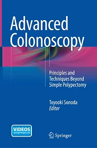 Advanced Colonoscopy: Principles And Techniques Beyond Simple Polypectomy