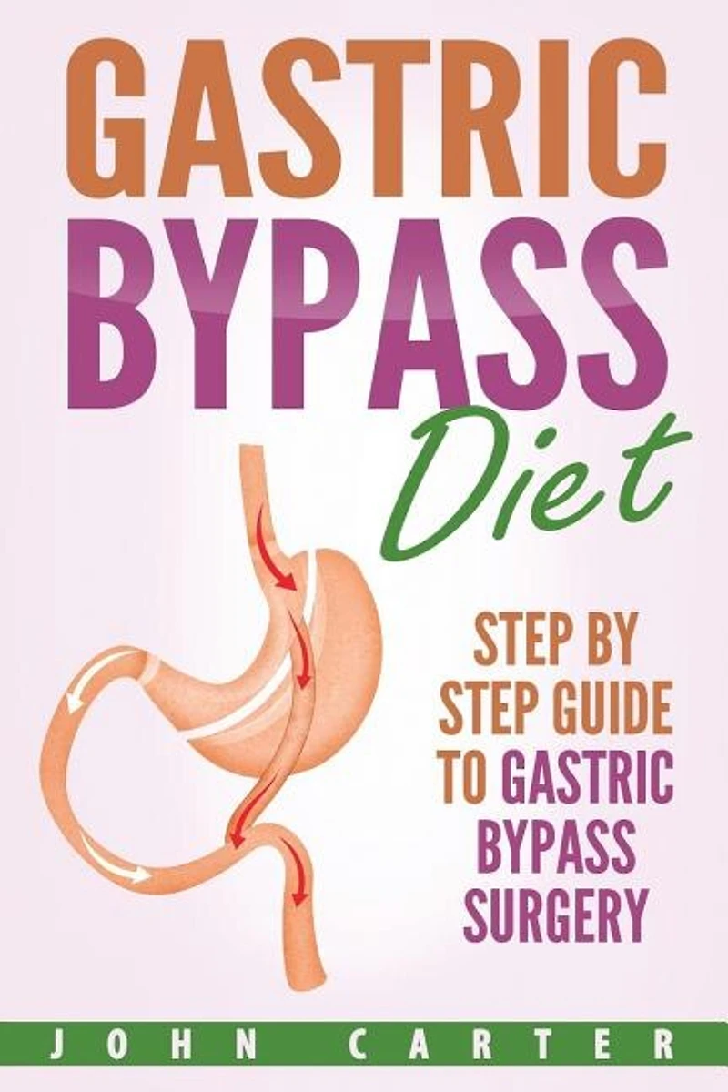 Gastric Bypass Diet: Step By Guide To Surgery