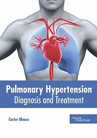 Pulmonary Hypertension: Diagnosis And Treatment