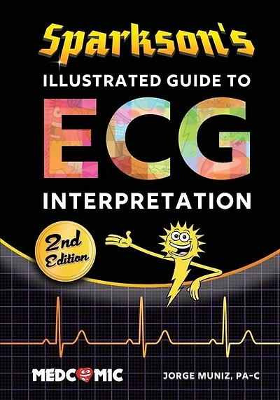 Sparkson's Illustrated Guide To Ecg Interpretation, 2nd Edition