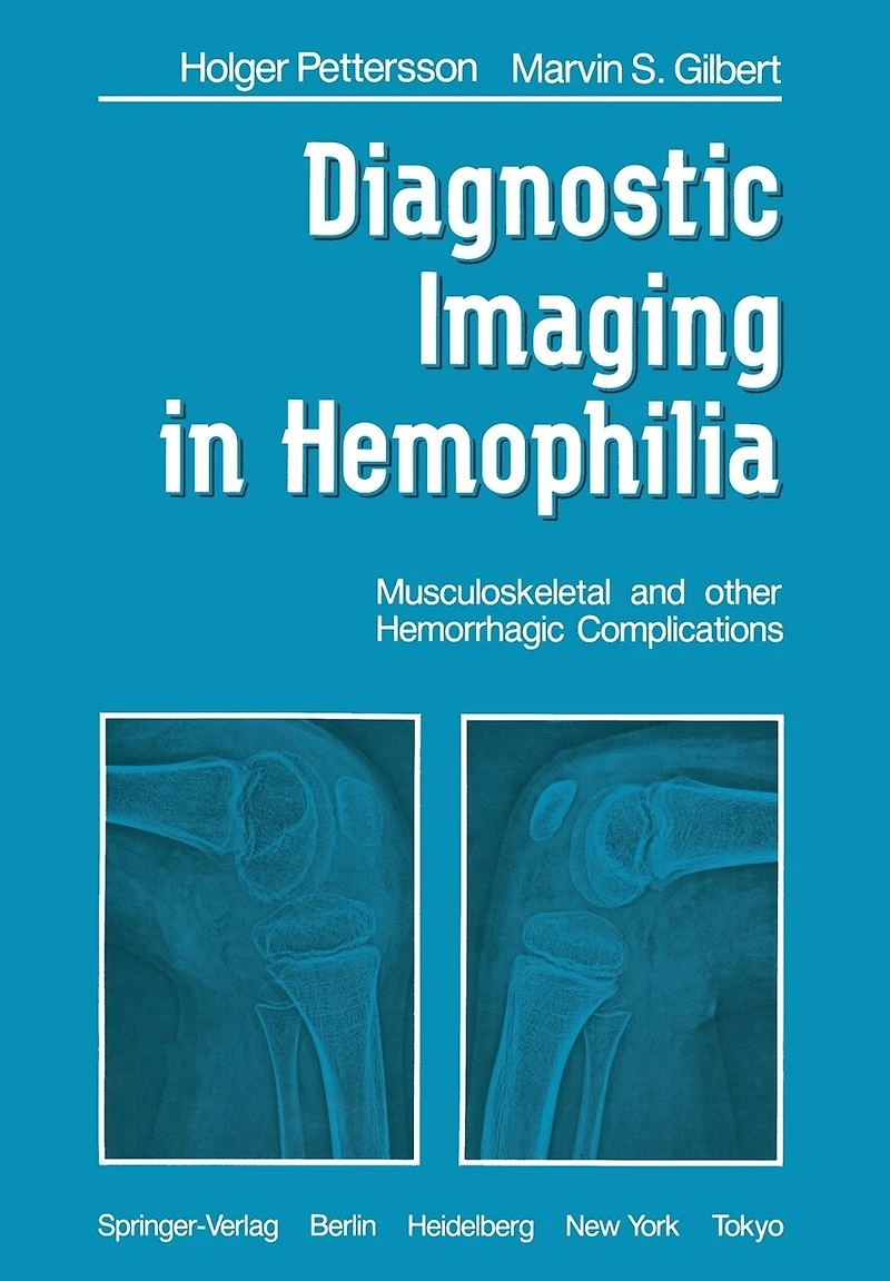 Diagnostic Imaging Hemophilia: Musculoskeletal and Other Hemorrhagic Complications