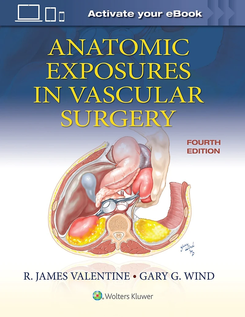 Anatomic Exposures Vascular Surgery