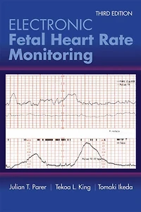 Electronic Fetal Heart Rate Monitoring: The 5-Tier System: The 5-Tier System