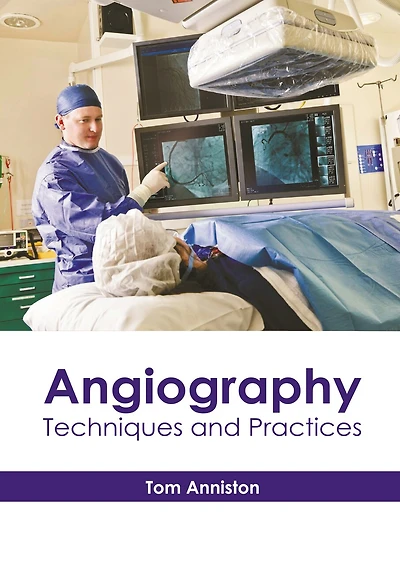 Angiography: Techniques And Practices