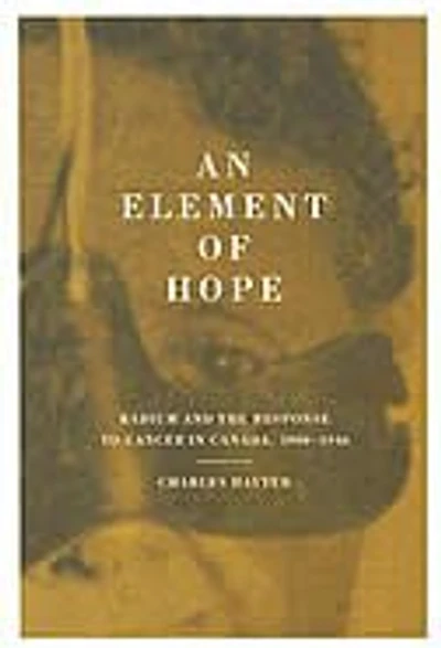 An Element of Hope: Radium and the Response to Cancer in Canada, 1900-1940