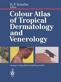 Colour Atlas of Tropical Dermatology and Venerology