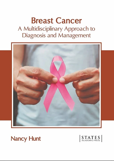Breast Cancer: A Multidisciplinary Approach To Diagnosis And Management