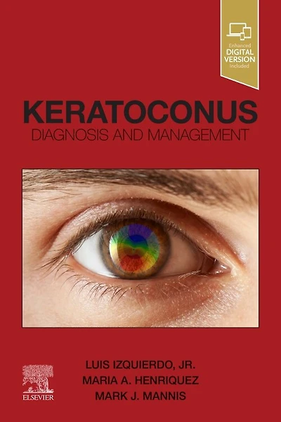 Keratoconus: Diagnosis And Management