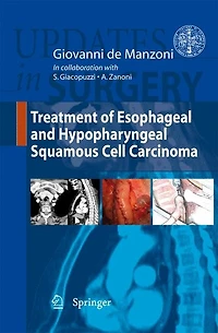 Treatment of Esophageal and Hypopharingeal Squamous Cell Carcinoma