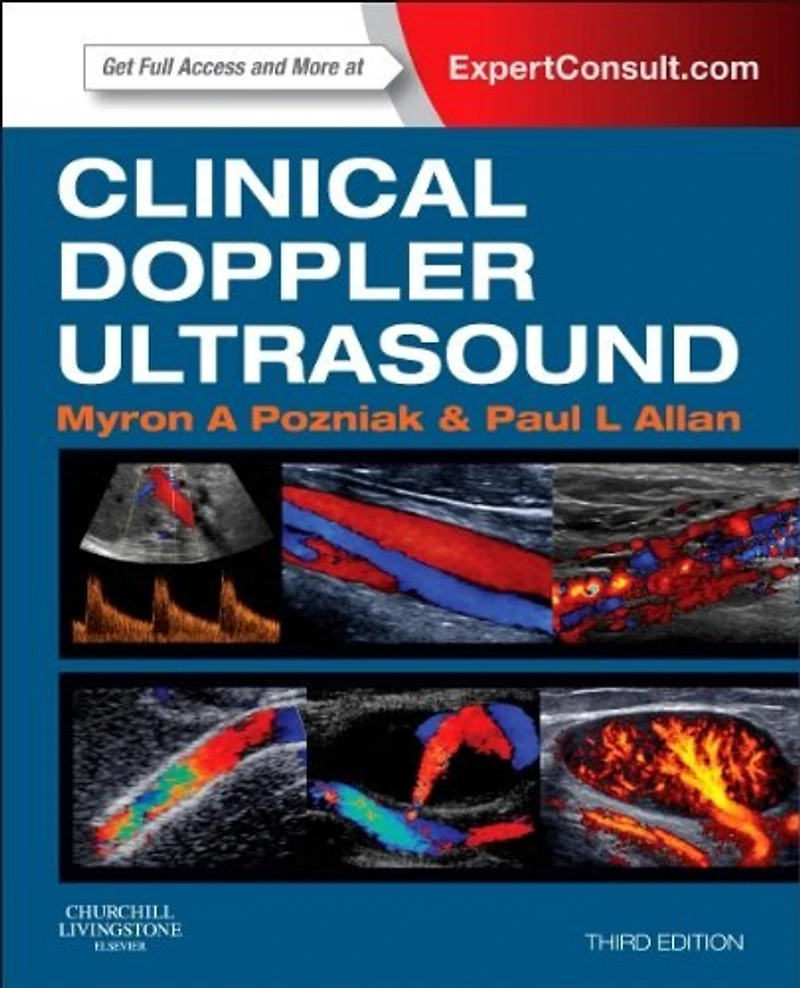 Clinical Doppler Ultrasound: Expert Consult: Online And Print
