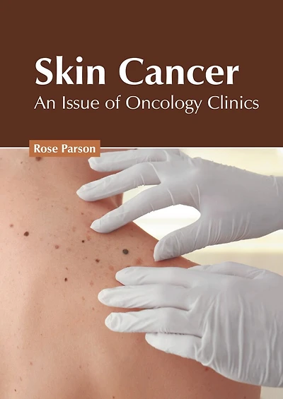 Skin Cancer: An Issue Of Oncology Clinics
