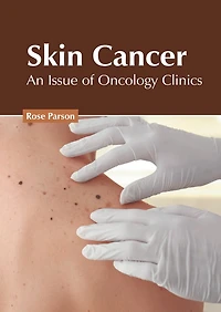 Skin Cancer: An Issue Of Oncology Clinics