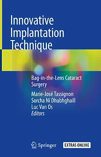 Innovative Implantation Technique: Bag-in-the-lens Cataract Surgery