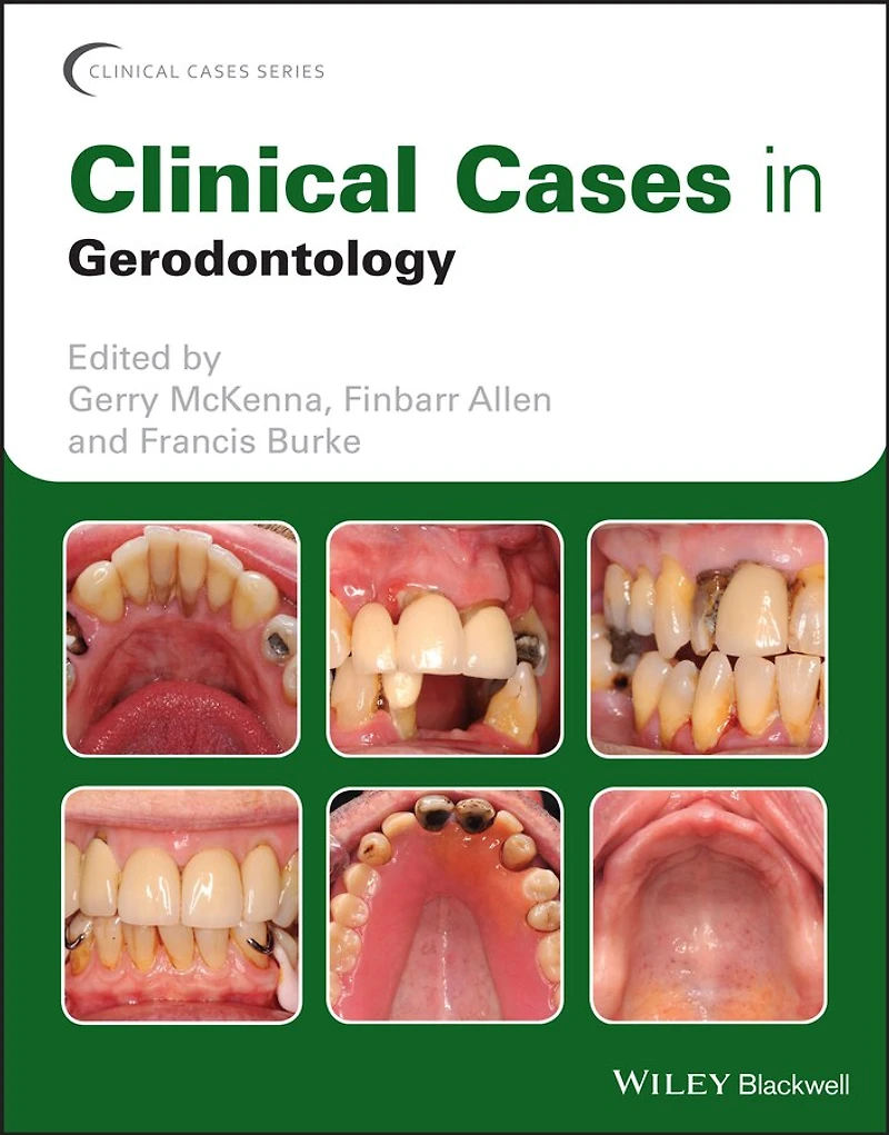 Clinical Cases Gerodontology