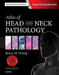 Atlas Of Head And Neck Pathology