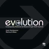 Evolution: Contemporary Protocols For Anterior Single-tooth Implants