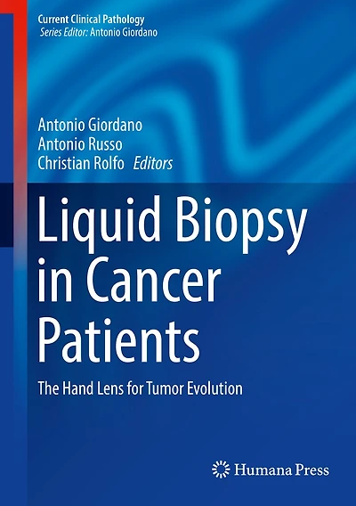 Liquid Biopsy Cancer Patients: The Hand Lens for Tumor Evolution